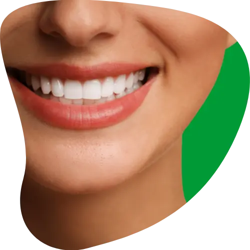 Sonrisa con imagen irregular